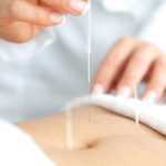 Abdominal acupuncture